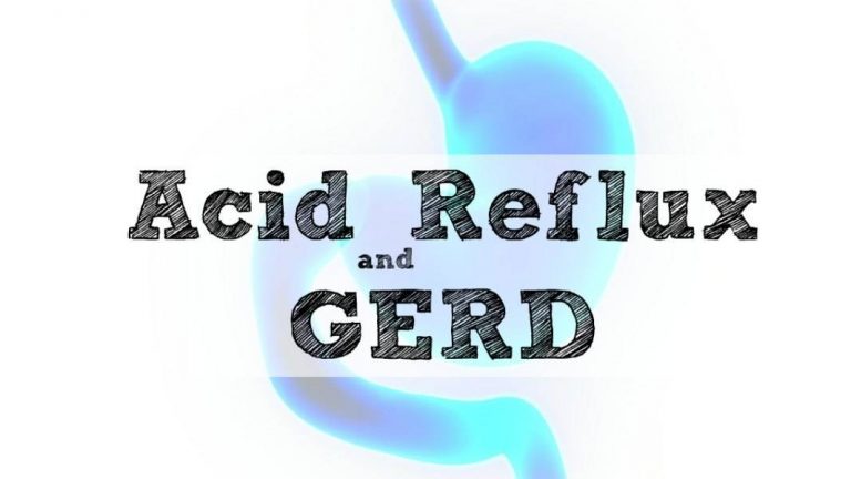 Cara Atasi Gerd Dan Asid Refluks